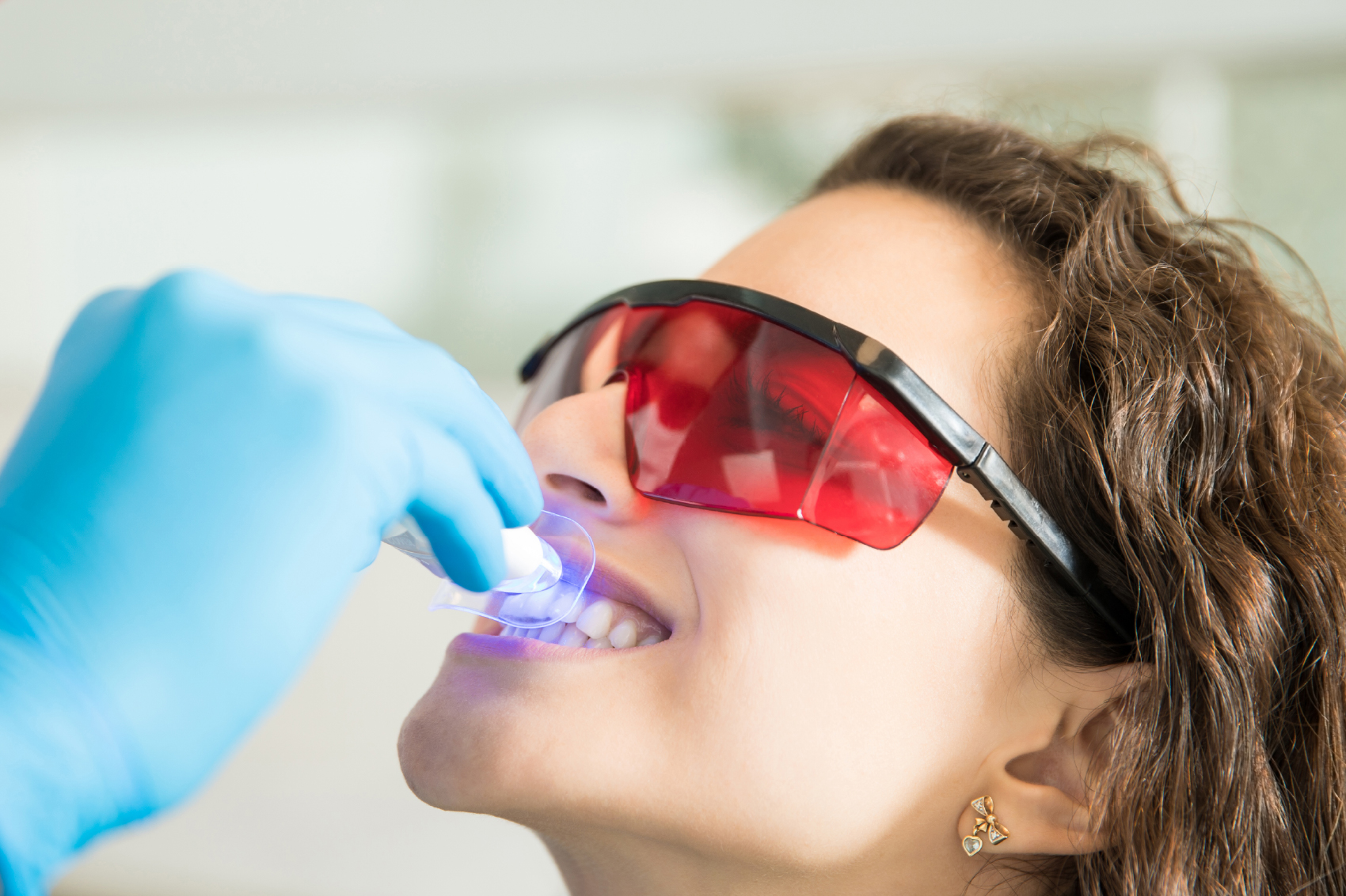 Estética dental y diseño de sonrisa