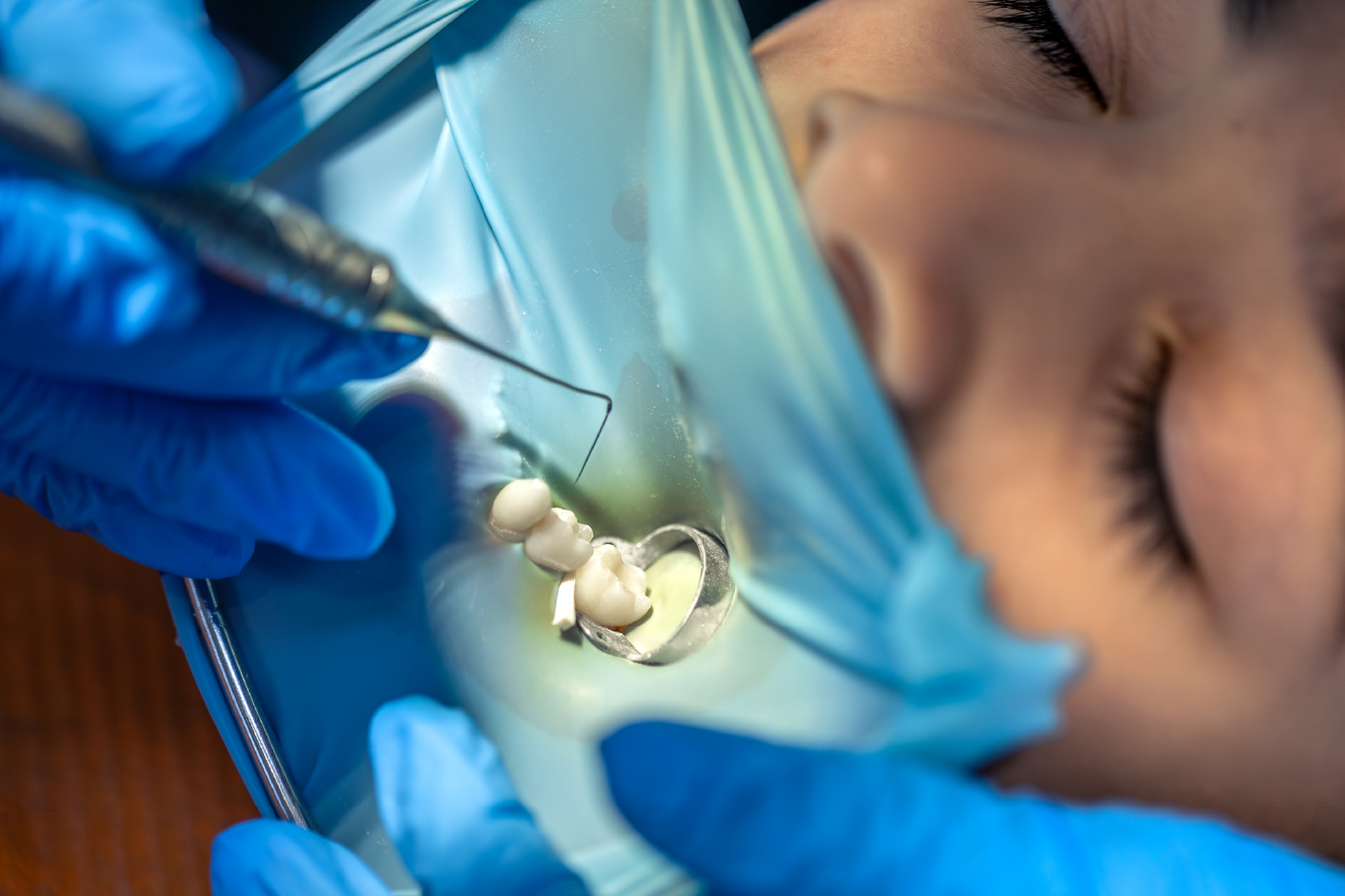 Cirugías oral y procedimientos quirúrgicos